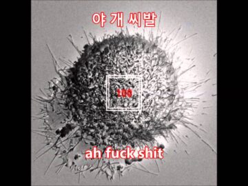 [ID: X2KmhMmqj_A] Youtube Automatic