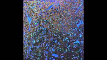 [ID: GxOeHIQvro4] Youtube Automatic