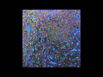 [ID: GxOeHIQvro4] Youtube Automatic