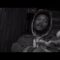 Young 99 – Bar Hoppin’ (Official Music Video)